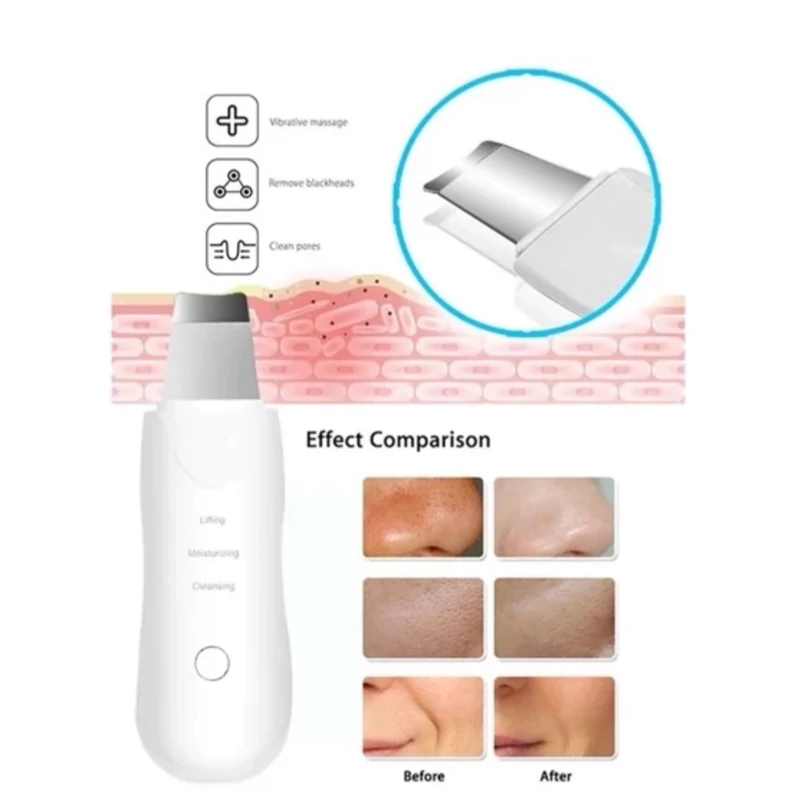 اتو صورت (دستگاه پاکسازی صورت)